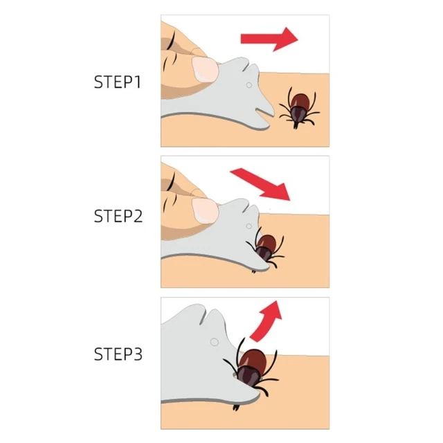 Pet Tick Remover Cards with Magnifier for Pets Dogs, Cat and Human Easy to Use 2
