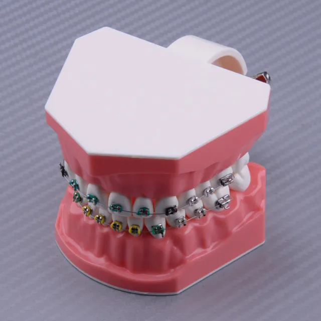 Modèle de démonstration de liens de ligature orthodontique pour dents dentaires