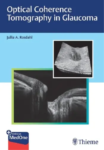 Rosdahl Optical Coherence Tomography in Glaucoma Book NEUF