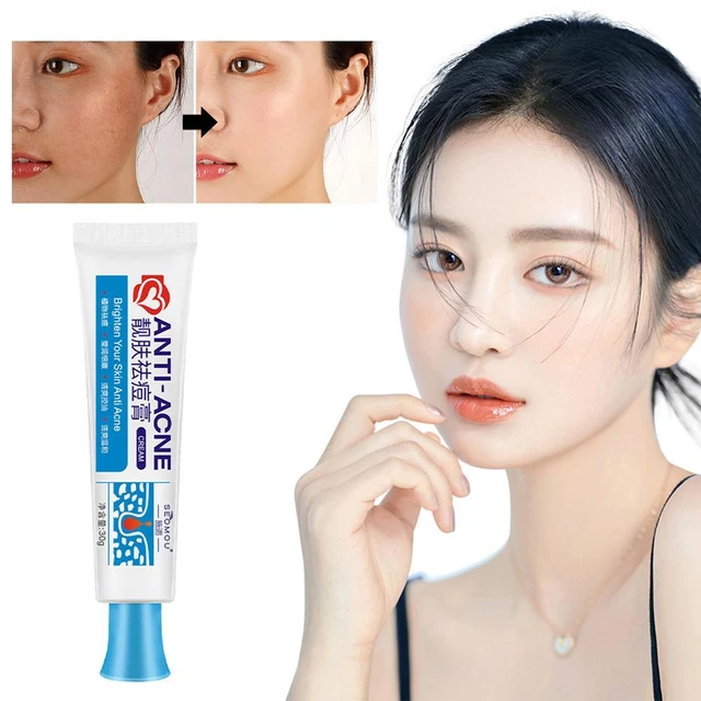 Rimuovi brufoli crema acne gel aloe vera cura cicatrici E7J4