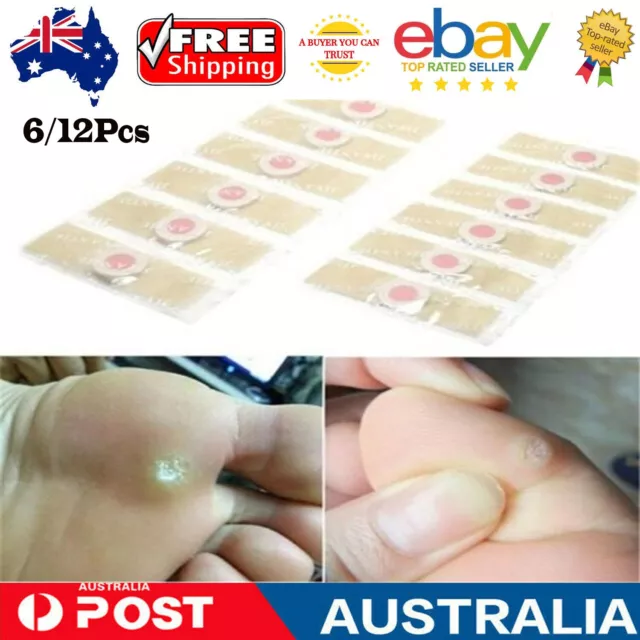BEST Foot Corn Remover Pads Plantar Wart Thorn Plaster Patch Callus Removal AU