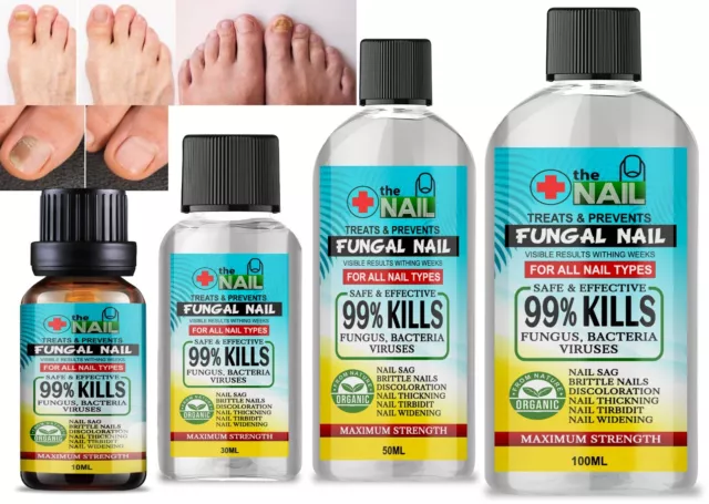 Nail Fungal Treatment Anti Fungus Infection Fungal Toe Nails Infection Care UK