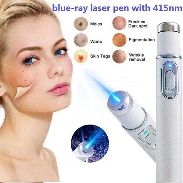 2 Pcs Terapia Luminosa Penna Acne, Penna Laser Non Invasiva Per La Rimozione Di Grani, Rimozione Dell'acne Luce Blu, Adatta A Tutti I Tipi Di Pelle - Foto 12
