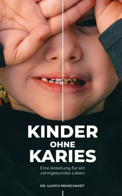Kinder ohne Karies | Ulrich Remschmidt | Taschenbuch | Klappenbroschur | 184 S.