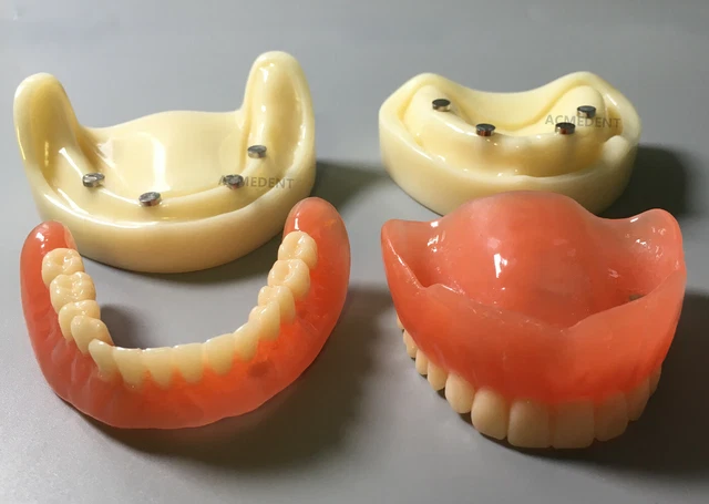 7 Stück/Kit Zahn über Prothese Männliche Kappen Gießbare Kugel Metall Gehäuse Retention Locator
