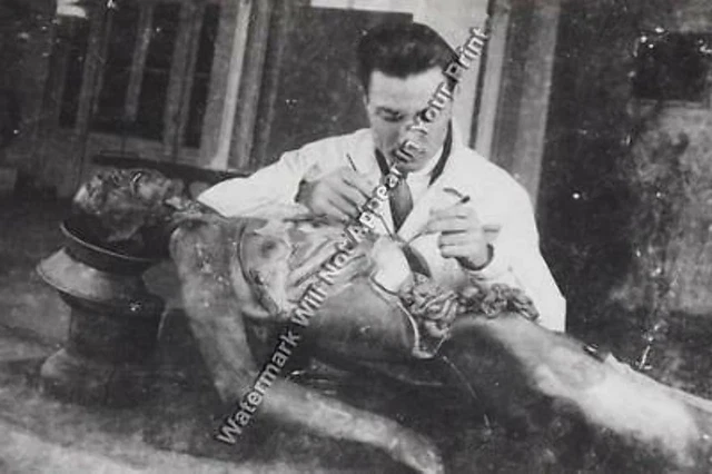 FREAKY A108 BIZARRE STRANGE ODD Human Cadaver Autopsy VINTAGE PHOTO WEIRD Pic