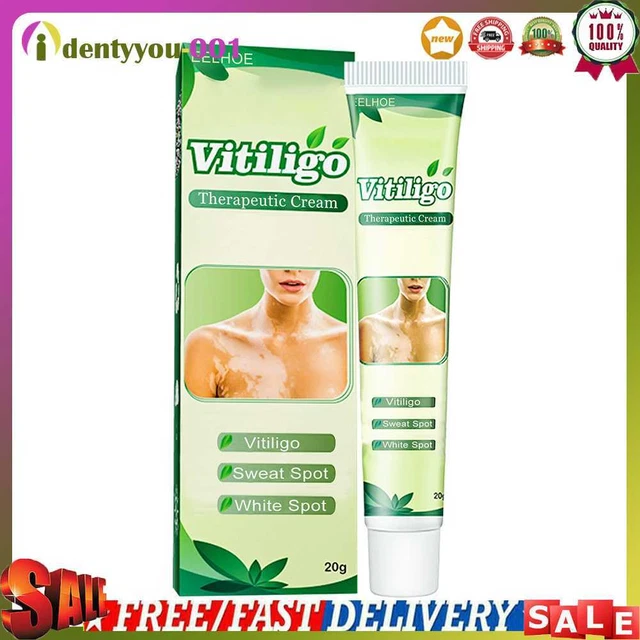 Crema terapéutica de vitiligo 20 g marcas tópicas de la piel cremas para el cuidado de la piel suministros para el cuidado de la piel