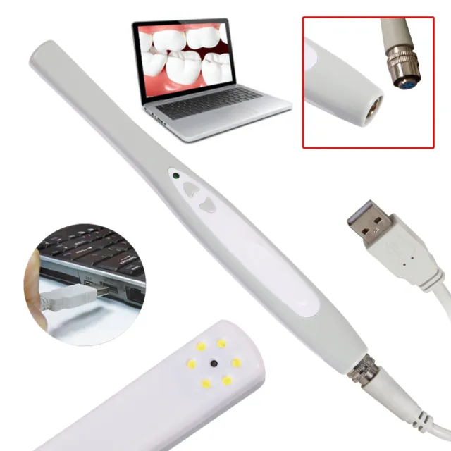 Dental Intraoral Oral Camera USB-X PRO Imaging System MD740 CN