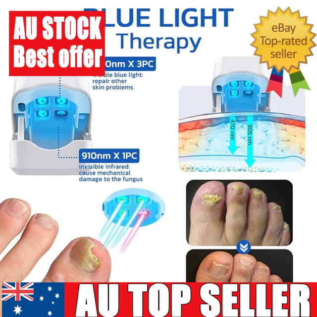 5 Easy Home Remedies for Summer Toenail Fungus — Valley Stream Podiatry