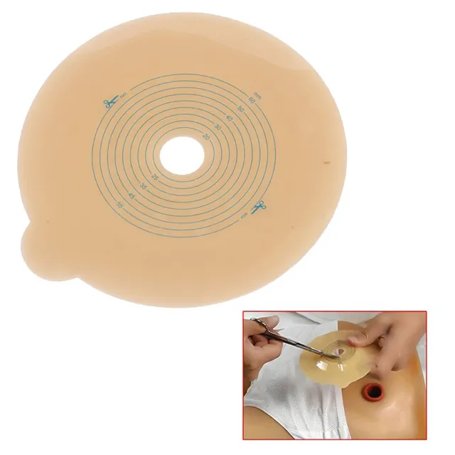 1 pieza de placa base sistema de dos piezas bolsa de ostomía placas base bolsas de colostomía estoma{