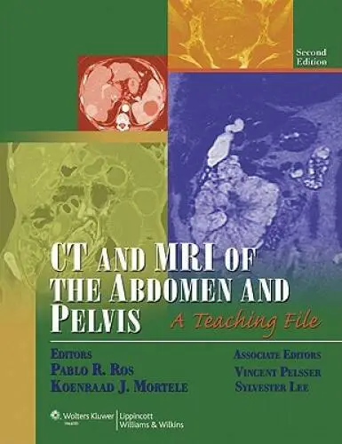 CT and MRI of the Abdomen and Pelvis: A Teaching File (LWW Teaching File  - GOOD
