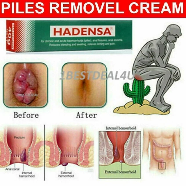 Ungüento Hadensa - pañal irritación piel seca radiación