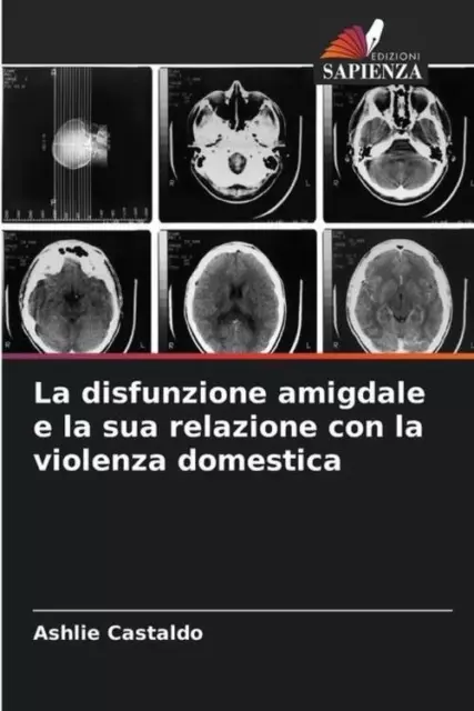 Ashlie Castaldo | La disfunzione amigdale e la sua relazione con la violenza...