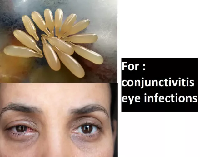 eye popta used to treat bacterial eye infections (such as conjunctivitis)