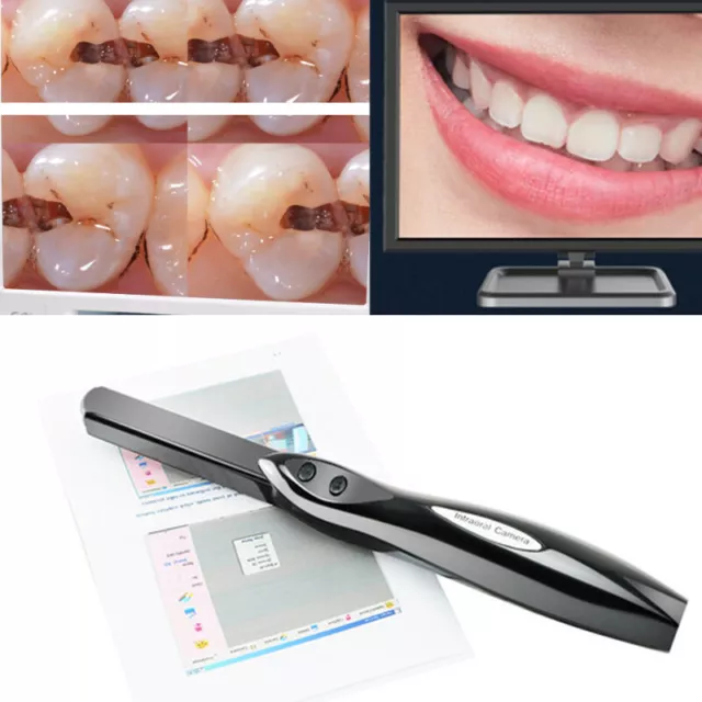 Dental HD CMOS USB Intraoral Intra Oral Camera 6 Mega Pixels 6-LED Clear Image