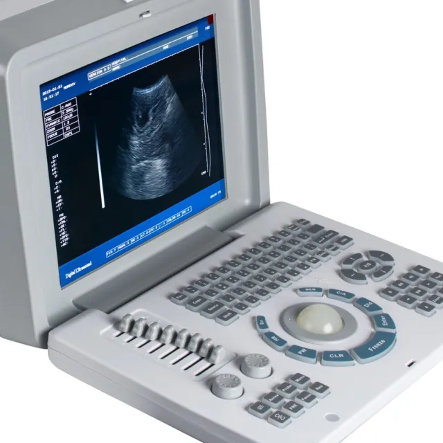 Carejoy Portable Laptop Full Ultrasound Scanner Machine with Convex Probe+3D