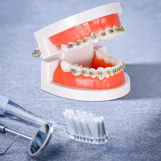 Dental Orthodontic Teeth Model With Metal Braces  School Teaching Equ.vio
