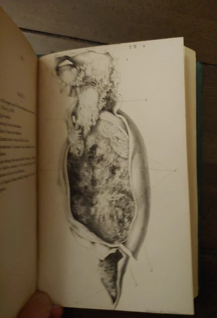 Rare Antique Medical Book Over 150 Years Old! Surgery Diseases  Oddities
