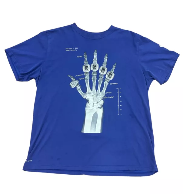 Kobe Broken Not Beaten Shirt NEW Kobe Bryant Shirt Kobe X Ray Shirt Kobe Rings Shirt Women Men Kobe 5 Rings Skeleton Shirt Sweatshirt Hoodie Kobe Tshirt - Laughinks