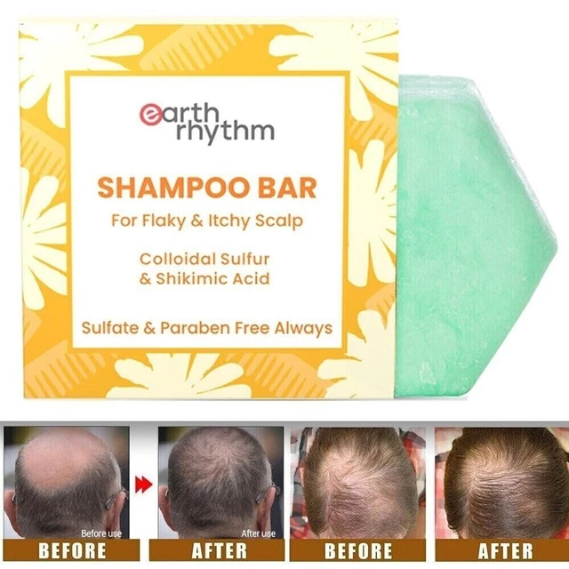 HANDMADE ANTIDANDRUFF SHAMPOO Bar for Hair Growth Care Soap 80g 18.27