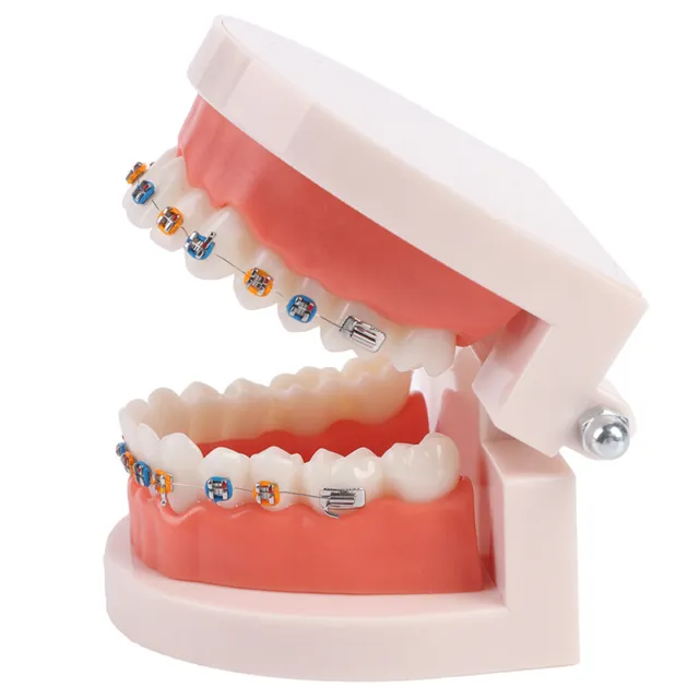 Dental Orthodontic Teeth Model With Metal Braces  School Teaching Equipme=t=
