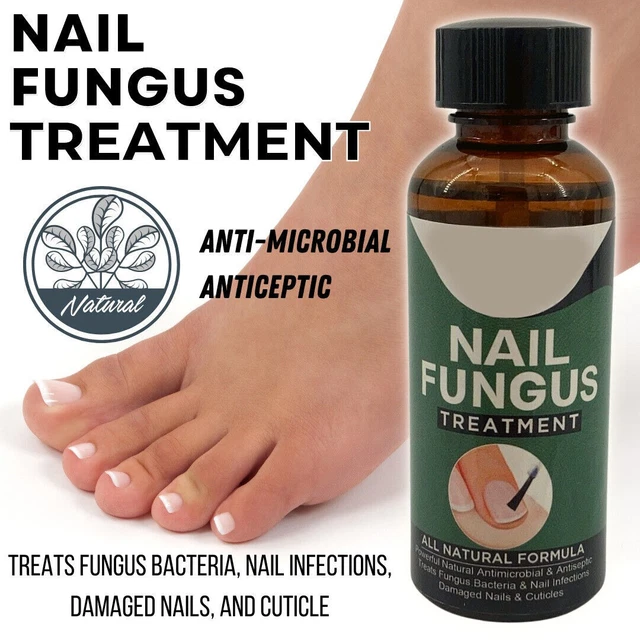 NAIL FUNGUS ANTIFUNGAL Home Treatment Toe and Finger Nail Infection