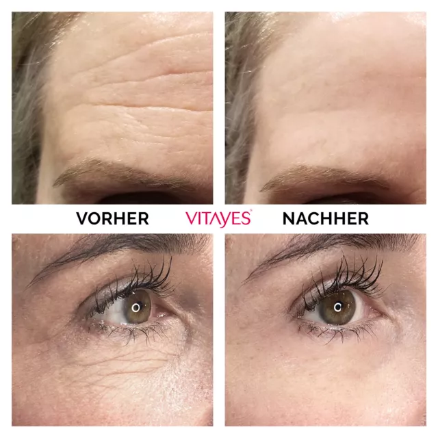 vitayes, Instant ageback, Lifting Creme (7ml) – glatte Haut in nur 5 Minuten. 3