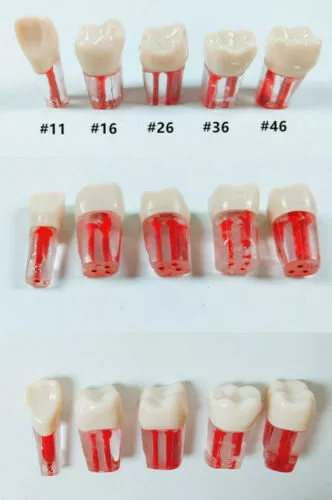 25*Dental Clear Root Canal Teeth Study Practice Model for Endodontic Pulp Files