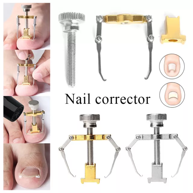 Correction Des Ongles Incarnés Lifter Tool Fixer Lisseur Correcteur Soins R