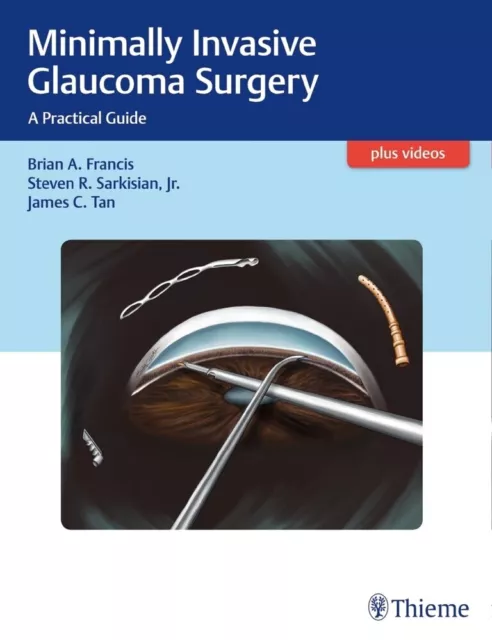 Minimally Invasive Glaucoma Surgery | 2016 | englisch