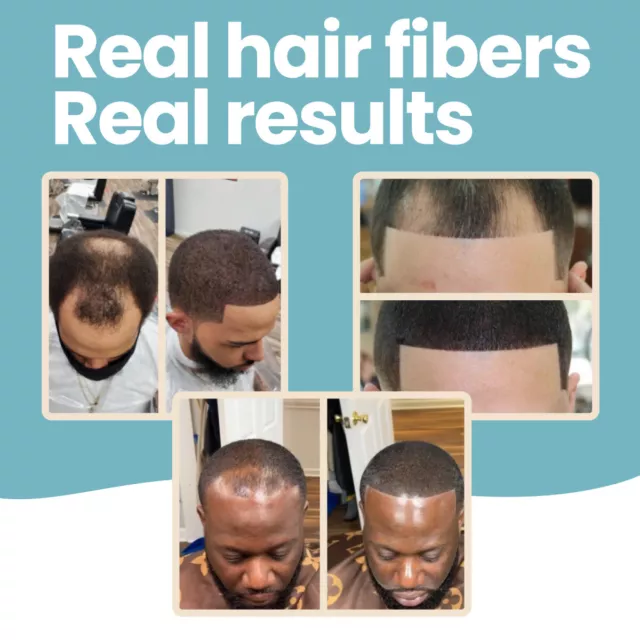 Hair Fibers by HAIR ILLUSION - Baldness & Thinning Hair Treatment for Men, Women