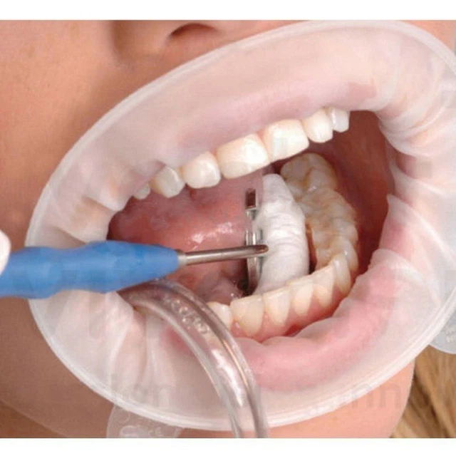 10 Dental Disposable Mouth Gag White Soft Sterile Rubber Dam Cheek Retractor