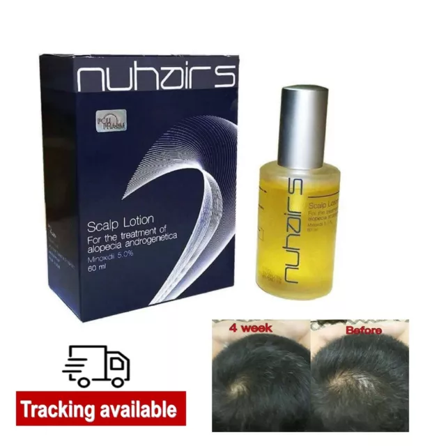 Nuhair 5 Hair Loss Alopecia Androgenetica Male Baldness Hair Lotion Hair Growth