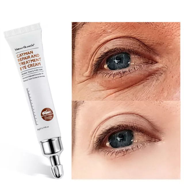 Cayman Eye Cream Instant Eye Bags Dark Circles Removal Anti Puffiness Wrinkle