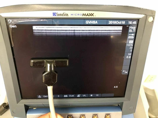 SONOSITE SLT 10/5 Intraoperative Linear Array Hockey Stick Ultrasound ...