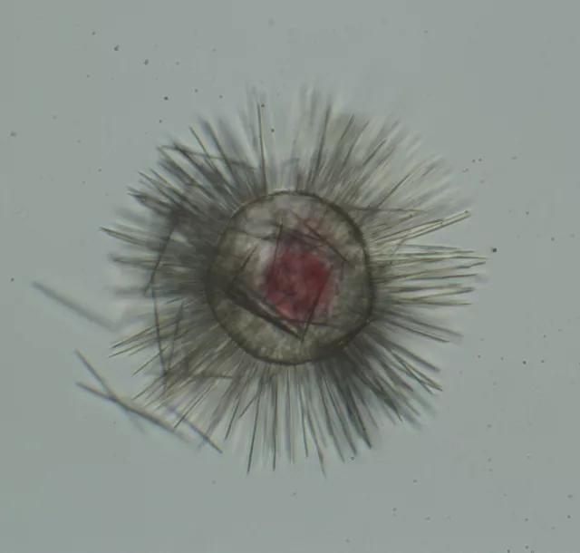 Vintage Microscope Slide of Protozoa. Acanthocystis Turfacea