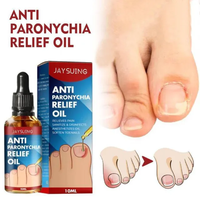 Nutrición para uñas alivio dolor uñas de los pies aceite reparación anti paroniquia Gesu Q