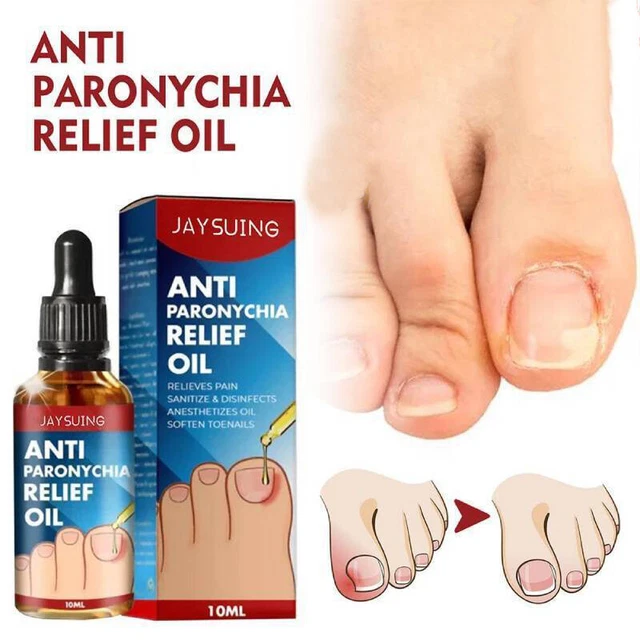 Ongle Nutrition Soulagement Douleur Huile Réparation Anti Paronychia Santé ,