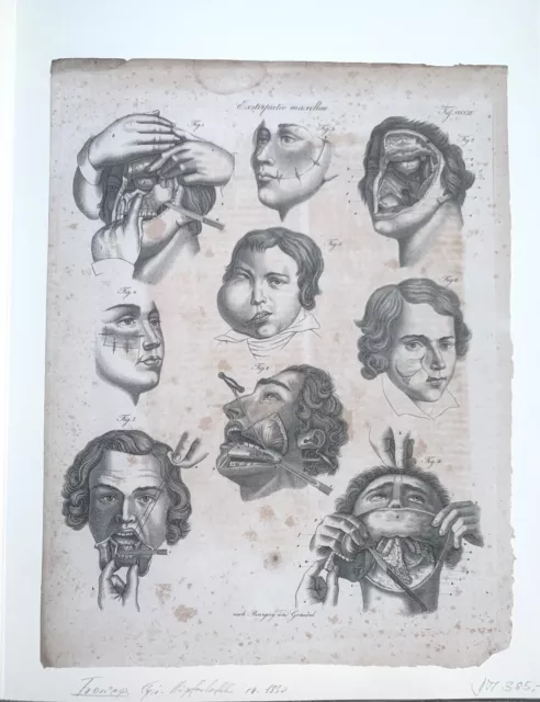 Anatomische Zeichnung: Jean Marc Boungery, ca. 1830