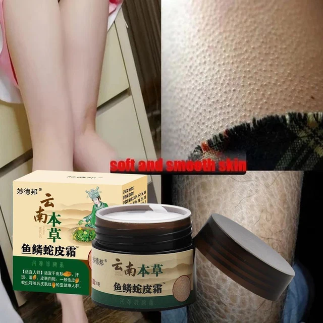 US CURING KERATOSIS Pilaris Chicken Skin Body Lotion Skin Repair skin