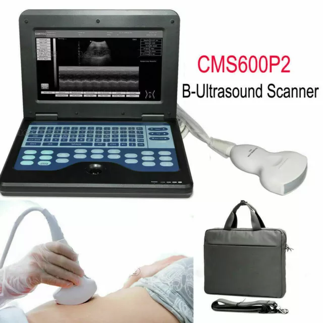 Portable CMS600P2 Laptop Ultrasound Scanner Machine With 3.5mhz Convex Probe