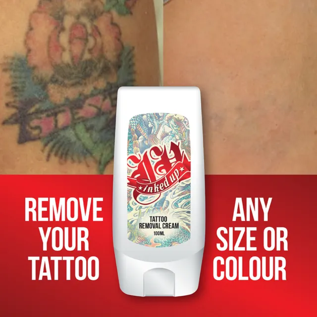 Inked Up Tattoo Removal Cream  Remove Your Tattoo India  Ubuy