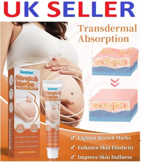 Stretch Mark Marks Removal Remover Scar Cream Gel Striae Gravidarum Pregnancy