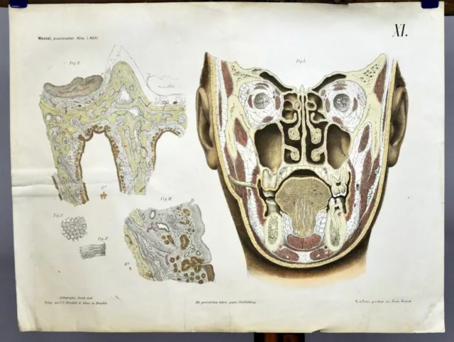 alte Wandkarte Medizin Anatomie menschlicher Kopf Lehrtafel retro Rollbild