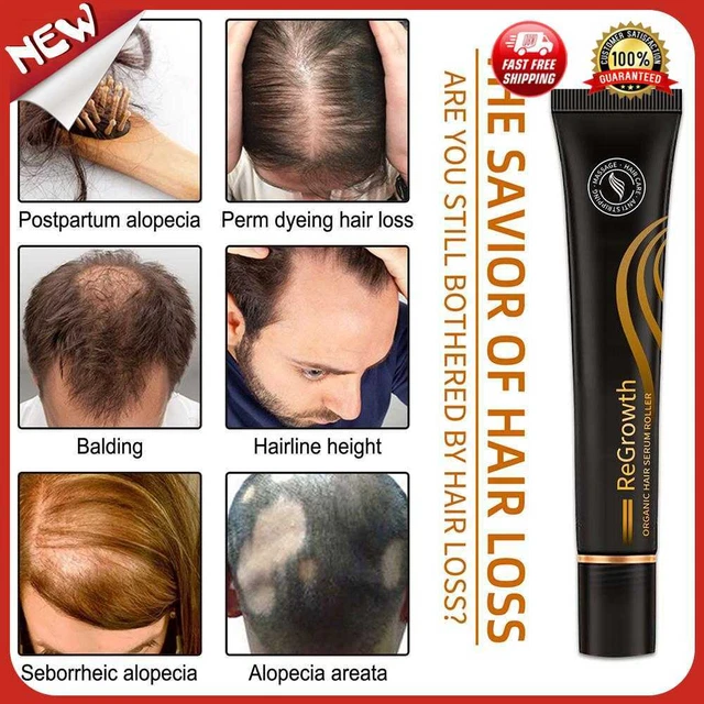 Rodillo de masaje nutritivo para el cuero cabelludo con esencia de crecimiento del cabello para el cuero cabelludo (con caja)