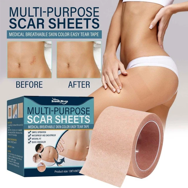 Flaw Hide Tape Birthmark Scar Acne Tattoo Cover Up Stickers Hide Concealing E9Y0