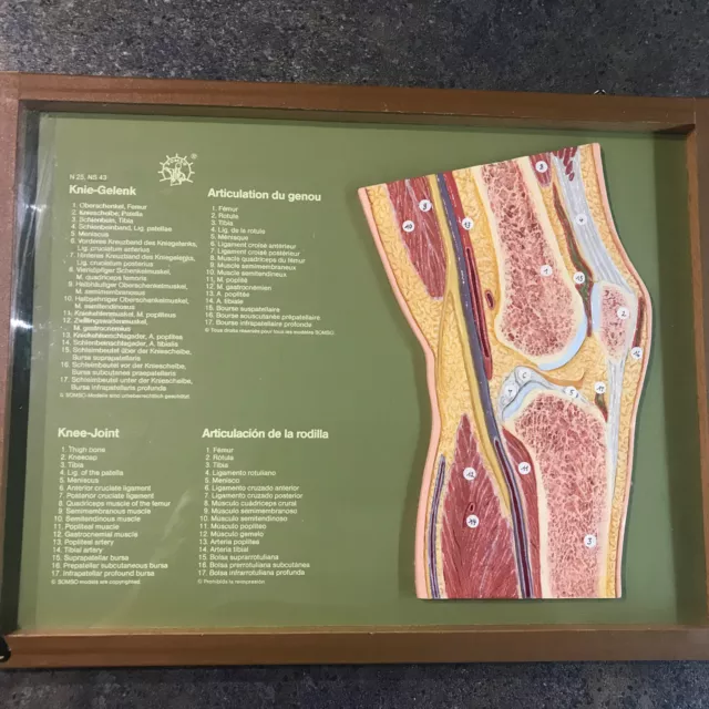 Anatomie Knie / Schulwandkarte , Lehrbild , Lehrkarte im Rahmen . 33 x 25 cm