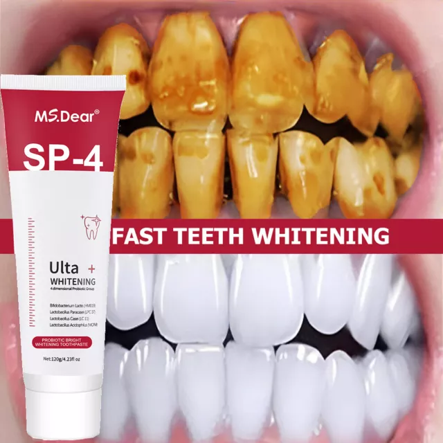 SP-4 Probiotic Toothpaste Tooth Whitening Toothpaste Fresh Breath Stain Removal