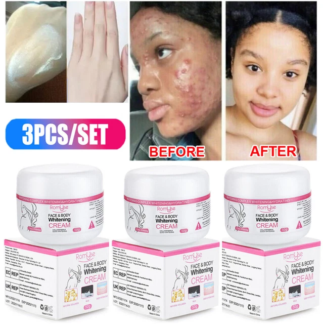 3PCS 3 Days Dark Skin Permanent Bleaching Cream Whitening Brightening Lightening