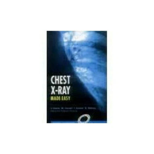 CHEST XRAY MADE Easy by Jonathan Corne (Consultant Respiratory